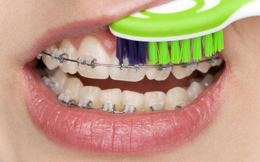 牙齿矫正松动？