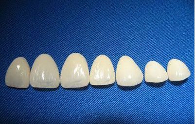 亳州烤瓷牙套种类和价格？