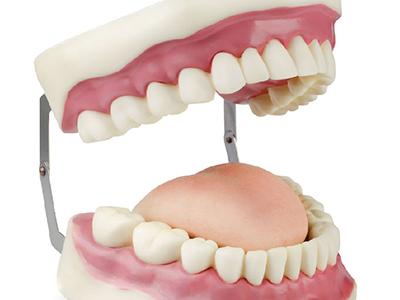 镶牙一般要多久？