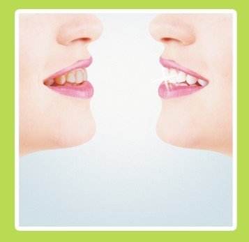 苏州美奥口腔四环素牙美白的价格? 苏州美奥口腔四环素牙美白的价格?